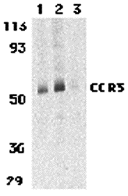 Western blot analysis of CCR3 in human spleen tissue lysates with CCR3 antibody at 1 (lane 1) and 2 μg/mL (lane 2), and 2 μg/mL in the presence of blocking peptide (lane 3). Western blot analysis of CCR3 in human spleen tissue lysates with CCR3 antibody at 1 (lane 1) and 2 μg/mL (lane 2), and 2 μg/mL in the presence of blocking peptide (lane 3).