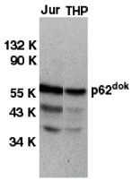 Western blot analysis of DOK1 in Jurkat (Jur) and THP-1 (THP) cell lysates with DOK1 antibody at 1 μg/mL. Western blot analysis of DOK1 in Jurkat (Jur) and THP-1 (THP) cell lysates with DOK1 antibody at 1 μg/mL.