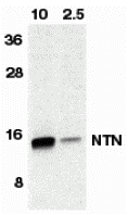 Western blot analysis of NTN in HeLa cell lyaste containing 10 or 2.5 ng of full length recombinant NTN with neurturin antibody at 1:500. Western blot analysis of NTN in HeLa cell lyaste containing 10 or 2.5 ng of full length recombinant NTN with neurturin antibody at 1:500.