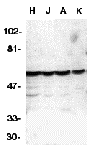 Western blot analysis of caspase-10 in HeLa (H), Jurkat (J), A431 (A), K562 (K) whole cell lysates with Caspase-10 antibody at 1 μg/mL. Western blot analysis of caspase-10 in HeLa (H), Jurkat (J), A431 (A), K562 (K) whole cell lysates with Caspase-10 antibody at 1 μg/mL.