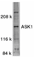 Western blot analysis of ASK1 in SW1353 whole cell lysate with ASK1 antibody at 1:500 dilution. Western blot analysis of ASK1 in SW1353 whole cell lysate with ASK1 antibody at 1:500 dilution.