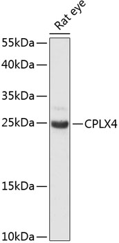 Western blot analysis of extracts of rat eye, using CPLX4 antibody (15-555) at 1:3000 dilution.<br/>Secondary antibody: HRP Goat Anti-Rabbit IgG (H+L) at 1:10000 dilution.<br/>Lysates/proteins: 25ug per lane.<br/>Blocking buffer: 3% nonfat dry milk in TBST.<br/>Detection: ECL Enhanced Kit.<br/>Exposure time: 90s. Western blot analysis of extracts of rat eye, using CPLX4 antibody (15-555) at 1:3000 dilution.<br/>Secondary antibody: HRP Goat Anti-Rabbit IgG (H+L) at 1:10000 dilution.<br/>Lysates/proteins: 25ug per lane.<br/>Blocking buffer: 3% nonfat dry milk in TBST.<br/>Detection: ECL Enhanced Kit.<br/>Exposure time: 90s.