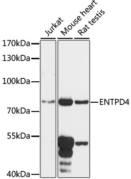 Western blot analysis of extracts of various cell lines, using ENTPD4 antibody (16-618) at 1:1000 dilution.<br/>Secondary antibody: HRP Goat Anti-Rabbit IgG (H+L) at 1:10000 dilution.<br/>Lysates/proteins: 25ug per lane.<br/>Blocking buffer: 3% nonfat dry milk in TBST.<br/>Detection: ECL Basic Kit.<br/>Exposure time: 90s. Western blot analysis of extracts of various cell lines, using ENTPD4 antibody (16-618) at 1:1000 dilution.<br/>Secondary antibody: HRP Goat Anti-Rabbit IgG (H+L) at 1:10000 dilution.<br/>Lysates/proteins: 25ug per lane.<br/>Blocking buffer: 3% nonfat dry milk in TBST.<br/>Detection: ECL Basic Kit.<br/>Exposure time: 90s.