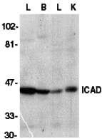 Secondary: Goat anti-rabbit IgG HRP conjugate at 1:10000 dilution. Secondary: Goat anti-rabbit IgG HRP conjugate at 1:10000 dilution.