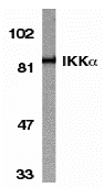 Western blot analysis of IKK alpha in HeLa whole cell lysate with IKK alpha antibody at 1:1000 dilution. Western blot analysis of IKK alpha in HeLa whole cell lysate with IKK alpha antibody at 1:1000 dilution.