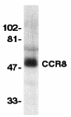Western blot analysis of CCR8 in human spleen lysate with CCR8 antibody at 1:500 dilution. Western blot analysis of CCR8 in human spleen lysate with CCR8 antibody at 1:500 dilution.