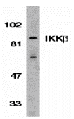 Western blot analysis of IKK beta in Jurkat whole cell lysate with IKK beta antibody (C3) at 1:500 dilution. Western blot analysis of IKK beta in Jurkat whole cell lysate with IKK beta antibody (C3) at 1:500 dilution.