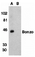 Western blot analysis of Bonzo in human spleen tissue lysate with Bonzo antibody at 1 μg/mL in (A) the absence or (B) the presence of blocking peptide.