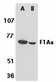 Western blot analysis of F1A alpha in mouse (A) and rat (B) liver tissue lysates with F1A alpha antibody at 1 μg/mL. Western blot analysis of F1A alpha in mouse (A) and rat (B) liver tissue lysates with F1A alpha antibody at 1 μg/mL.