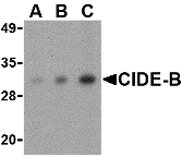 Western blot analysis of CIDE-B in mouse small intestine tissue lysate with CIDE-B antibody at (A) 0.5, (B) 1 and (C) 2 μg/mL. Western blot analysis of CIDE-B in mouse small intestine tissue lysate with CIDE-B antibody at (A) 0.5, (B) 1 and (C) 2 μg/mL.