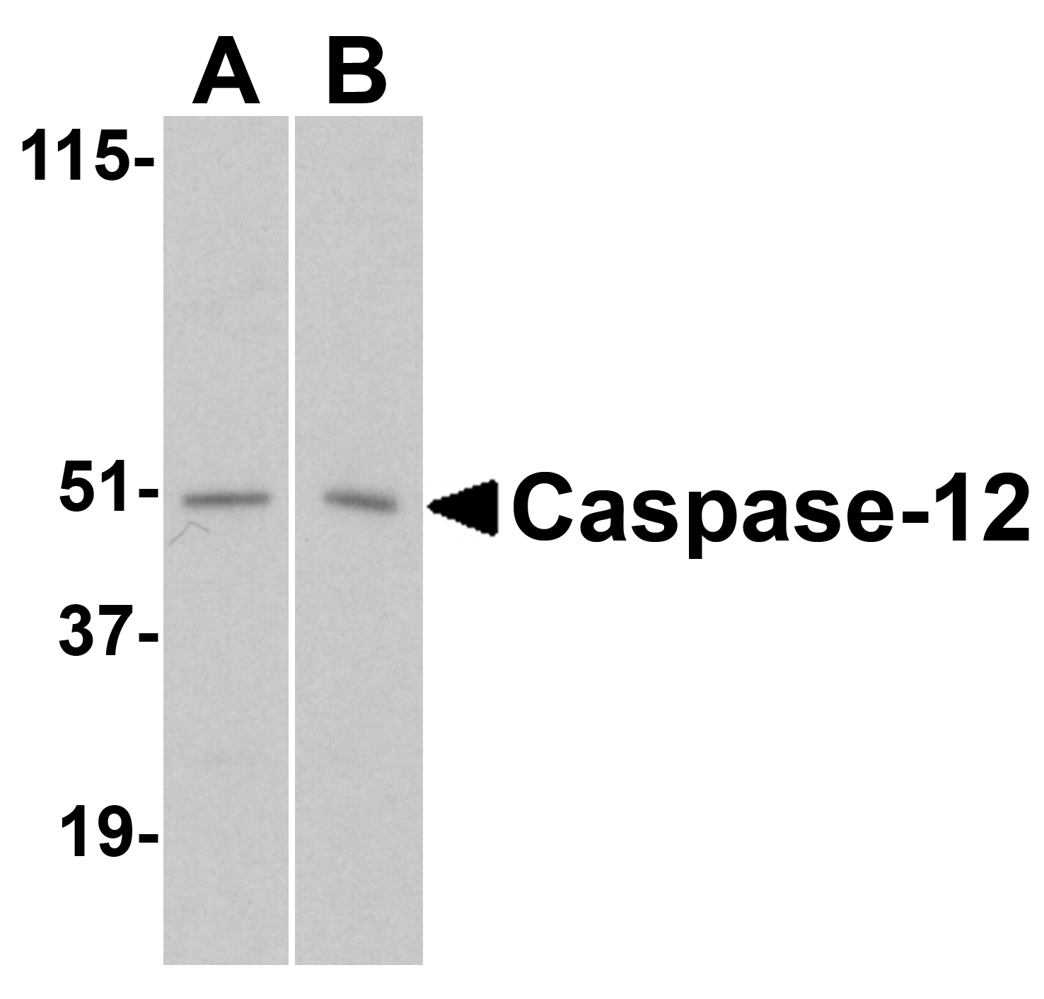 Western blot analysis of caspase-12 in (A) human and (B) mouse spleen tissue lysates with caspase-12 antibody at 1 μg/mL. Western blot analysis of caspase-12 in (A) human and (B) mouse spleen tissue lysates with caspase-12 antibody at 1 μg/mL.