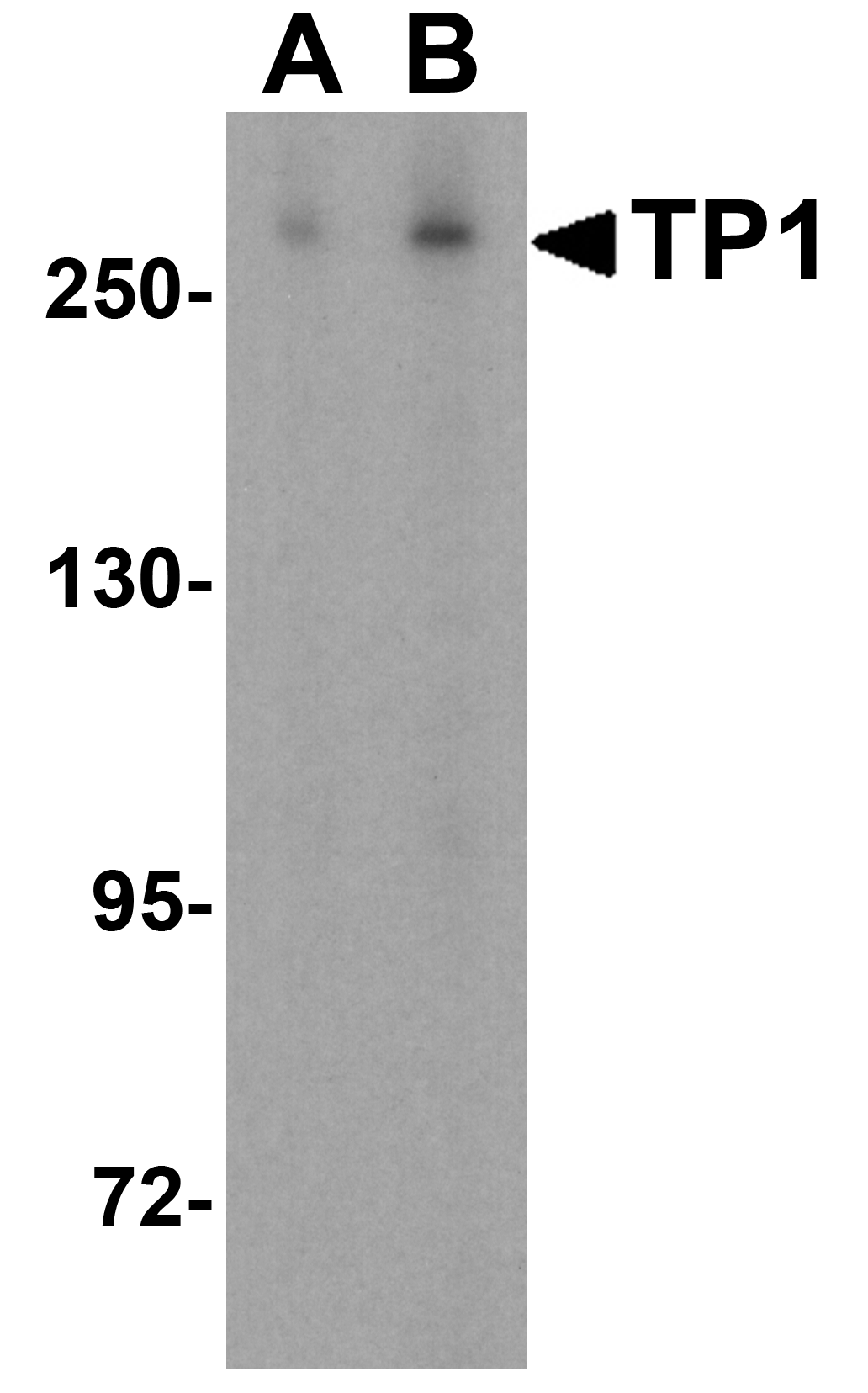Western blot analysis of TP1 in human kidney tissue lysate with TP1 antibody at (A) 0.5 and (B) 1 μg/mL.