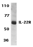 Western blot analysis of IL-22 Receptor expression in human HepG2 cell lysate with IL-22 Receptor antibody at 1 μg/ml. Western blot analysis of IL-22 Receptor expression in human HepG2 cell lysate with IL-22 Receptor antibody at 1 μg/ml.