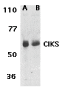 Western blot analysis of CIKS expression in human lung (lane A) and placenta (lane B) tissue lysates with CIKS antibody at 1 μg/ml. Western blot analysis of CIKS expression in human lung (lane A) and placenta (lane B) tissue lysates with CIKS antibody at 1 μg/ml.
