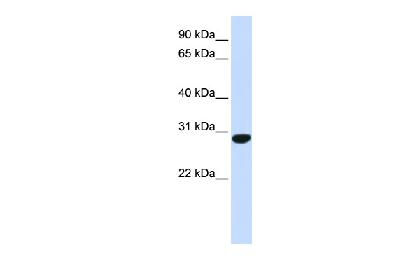 Antibody used in WB on Human Muscle at 0.2-1 ug/ml. Antibody used in WB on Human Muscle at 0.2-1 ug/ml.