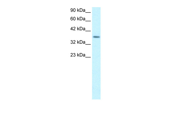 Antibody used in WB on Human Jurkat 1.25 ug/ml. Antibody used in WB on Human Jurkat 1.25 ug/ml.