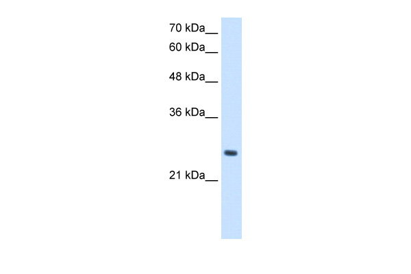Antibody used in WB on Human HepG2 at 2.5 ug/ml. Antibody used in WB on Human HepG2 at 2.5 ug/ml.