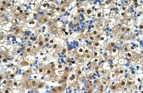 Antibody used in IHC on Human Liver. Antibody used in IHC on Human Liver.