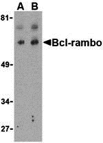 Western blot analysis of Bcl-rambo in K562 cell lysate with Bcl-rambo antibody at (A) 2 and (B) 4 μg/mL. Western blot analysis of Bcl-rambo in K562 cell lysate with Bcl-rambo antibody at (A) 2 and (B) 4 μg/mL.