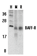 Western blot analysis of BAFF Receptor in human (H), mouse (M), and rat (R) spleen tissue lysates with BAFF Receptor antibody at 5 μg/mL. Western blot analysis of BAFF Receptor in human (H), mouse (M), and rat (R) spleen tissue lysates with BAFF Receptor antibody at 5 μg/mL.