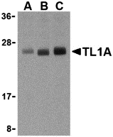 Western blot analysis of TL1A in PC-3 cell lysates with TL1A antibody at (A) 0.5, (B) 1, and (C) 2 μg/mL. Western blot analysis of TL1A in PC-3 cell lysates with TL1A antibody at (A) 0.5, (B) 1, and (C) 2 μg/mL.