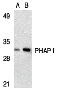 <strong>Figure 1 Western Blot Validation in Human Raji Cell Lysate</strong><br>
Loading: 15 μg of lysates per lane.
Antibodies: PHAP I 3145 (A: 2 μg/mL, B: 4 μg/mL), 1h incubation at RT in 5% NFDM/TBST.
Secondary: Goat anti-rabbit IgG HRP conjugate at 1:10000 dilution. <strong>Figure 1 Western Blot Validation in Human Raji Cell Lysate</strong><br>
Loading: 15 μg of lysates per lane.
Antibodies: PHAP I 3145 (A: 2 μg/mL, B: 4 μg/mL), 1h incubation at RT in 5% NFDM/TBST.
Secondary: Goat anti-rabbit IgG HRP conjugate at 1:10000 dilution.
