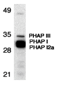 Western blot analysis of PHAP expression in human Raji cell lysate with PHAP antibody at 1 μg/mL. The wide and strong band below PHAP III is a doublelet composed of PHAP I (upper) and PHAP I2a (lower). Western blot analysis of PHAP expression in human Raji cell lysate with PHAP antibody at 1 μg/mL. The wide and strong band below PHAP III is a doublelet composed of PHAP I (upper) and PHAP I2a (lower).