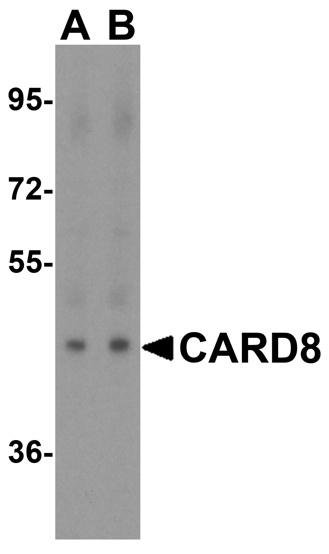 Western blot analysis of CARD8 expression in human lung tissue lysate with CARD8 antibody at (A) 1 and (B) 2 μg/ml. Western blot analysis of CARD8 expression in human lung tissue lysate with CARD8 antibody at (A) 1 and (B) 2 μg/ml.