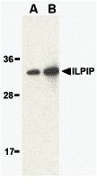 Western blot analysis of ILPIP in human brain lysate with ILPIP antibody at (A) 1 and (B) 2 μg/mL. Western blot analysis of ILPIP in human brain lysate with ILPIP antibody at (A) 1 and (B) 2 μg/mL.