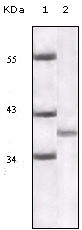 Western blot analysis using P16 monoclonal antibody against truncated P16 recombinant protein. Western blot analysis using P16 monoclonal antibody against truncated P16 recombinant protein.