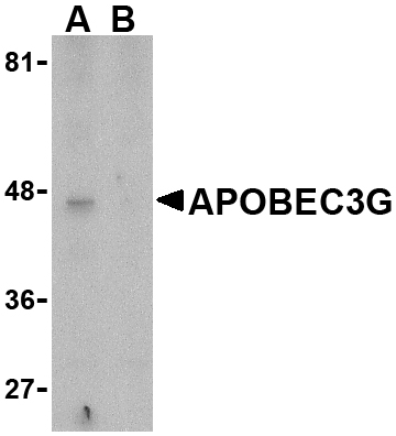 Western blot analysis of APOBEC3G expression in Caco-2 cell lysate in the (A), absence and (B) presence of blocking peptide with APOBEC3G antibody at 5 μg/mL. Western blot analysis of APOBEC3G expression in Caco-2 cell lysate in the (A), absence and (B) presence of blocking peptide with APOBEC3G antibody at 5 μg/mL.