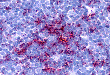 Immunohistochemistry of TLR8 in human thymus tissue with TLR8 antibody at 5 μg/mL. Immunohistochemistry of TLR8 in human thymus tissue with TLR8 antibody at 5 μg/mL.