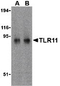 Western blot analysis of TLR11 in RAW264.7 cell lysates with TLR11 antibody at (A) 0.5 and (B) 1 μg/mL. Western blot analysis of TLR11 in RAW264.7 cell lysates with TLR11 antibody at (A) 0.5 and (B) 1 μg/mL.