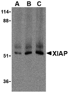 Western blot analysis of XIAP in human kidney lysate with XIAP antibody at (A) 0.5, (B) 1 , and (C) 2 μg/mL, respectively. Western blot analysis of XIAP in human kidney lysate with XIAP antibody at (A) 0.5, (B) 1 , and (C) 2 μg/mL, respectively.