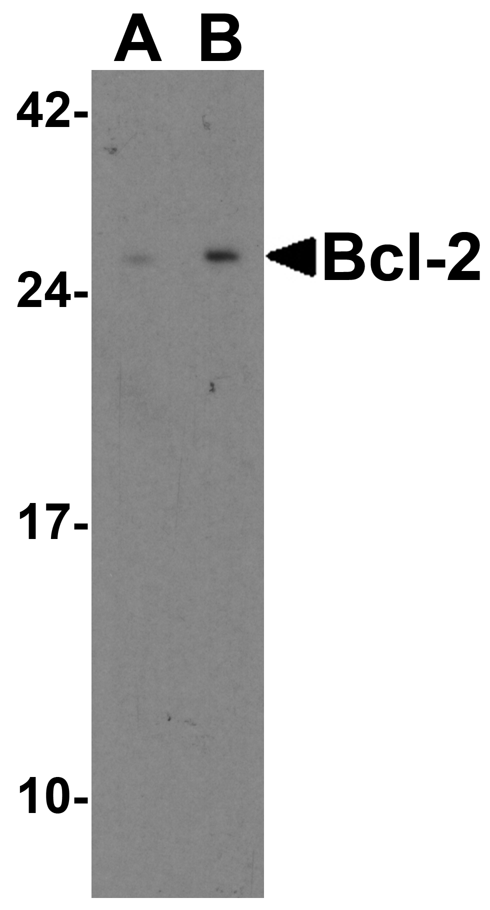 <strong>Figure 1 Western Blot Validation in Human and Mouse Cell Lines </strong><br>
Loading: 15 μg of lysates per lane.
Antibodies: Bcl-2 3335, (2 μg/mL), 1h incubation at RT in 5% NFDM/TBST.
Secondary: Goat anti-rabbit IgG HRP conjugate at 1:10000 dilution.
Lane A: Human Daudi cells
Lane B: Mouse A-20 cells <strong>Figure 1 Western Blot Validation in Human and Mouse Cell Lines </strong><br>
Loading: 15 μg of lysates per lane.
Antibodies: Bcl-2 3335, (2 μg/mL), 1h incubation at RT in 5% NFDM/TBST.
Secondary: Goat anti-rabbit IgG HRP conjugate at 1:10000 dilution.
Lane A: Human Daudi cells
Lane B: Mouse A-20 cells
