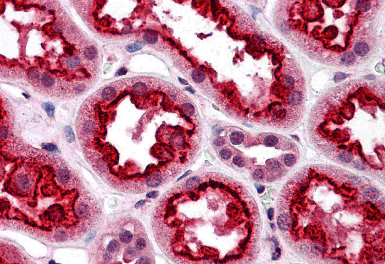 Immunohistochemistry of TAB3 in human kidney tissue with TAB3 antibody at 5 μg/mL. Immunohistochemistry of TAB3 in human kidney tissue with TAB3 antibody at 5 μg/mL.
