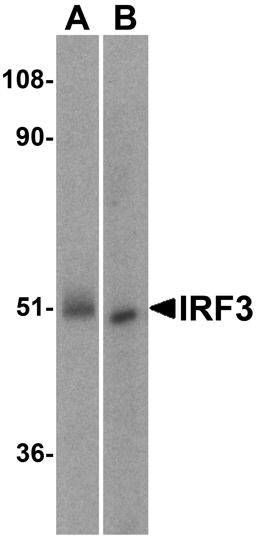 Western blot analysis of IRF3 in (A) human kidney and (B) rat kidney lysate with IRF3 antibody at 1 μg/mL.. Western blot analysis of IRF3 in (A) human kidney and (B) rat kidney lysate with IRF3 antibody at 1 μg/mL..