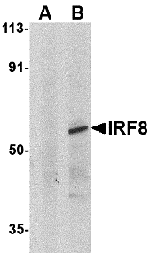 Western blot analysis of IRF8 in human thymus tissue lysate with IRF8 antibody at 1μg/mL in (A) the presence and (B) absence of blocking peptide. Western blot analysis of IRF8 in human thymus tissue lysate with IRF8 antibody at 1μg/mL in (A) the presence and (B) absence of blocking peptide.