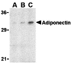 Western blot analysis of adiponectin in rat brain cell lysate with adiponectin antibody at (A) 1, (B) 2, and (C) 4 μg/mL. Western blot analysis of adiponectin in rat brain cell lysate with adiponectin antibody at (A) 1, (B) 2, and (C) 4 μg/mL.