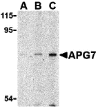 Western blot analysis of APG7 in L1210 cell lysate with APG7 antibody at (A) 1, (B) 2 and (C) 4 μg/mL. Western blot analysis of APG7 in L1210 cell lysate with APG7 antibody at (A) 1, (B) 2 and (C) 4 μg/mL.