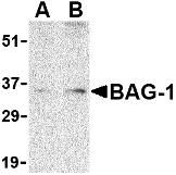 Western blot analysis of BAG-1 in PC-3 cell lysate with BAG-1 antibody at (A) 1 and (B) 2 μg/mL. Western blot analysis of BAG-1 in PC-3 cell lysate with BAG-1 antibody at (A) 1 and (B) 2 μg/mL.