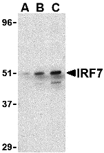 Western blot analysis of IRF7 in 293 whole cell lysate with IRF7 antibody at (A) 0.5, (B) 1, and (C) 2 μg/mL. Western blot analysis of IRF7 in 293 whole cell lysate with IRF7 antibody at (A) 0.5, (B) 1, and (C) 2 μg/mL.