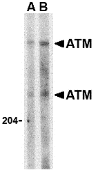 Western blot analysis of ATM in Daudi whole cell lysate with ATM antibody at (A) 1 and (B) 2 μg/mL.