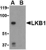 Western blot analysis of LKB1 in PC-3 cell lysate with LKB1 antibody at 1 μg/mL in the (A) absence or (B) presence of blocking peptide. Western blot analysis of LKB1 in PC-3 cell lysate with LKB1 antibody at 1 μg/mL in the (A) absence or (B) presence of blocking peptide.