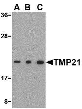 Western blot analysis of TMP21 in Raji cell lysate with TMP21 antibody at (A) 0.5 and (B) 1 and (C) 2 μg/mL. Western blot analysis of TMP21 in Raji cell lysate with TMP21 antibody at (A) 0.5 and (B) 1 and (C) 2 μg/mL.