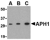 Western blot analysis of APH1 in RAW264.7 cell lysate with APH1 antibody at (A) 0.5, (B) 1 and (C) 2 μg/mL. Western blot analysis of APH1 in RAW264.7 cell lysate with APH1 antibody at (A) 0.5, (B) 1 and (C) 2 μg/mL.