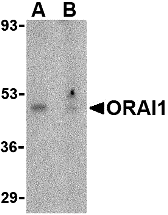 Western blot analysis of ORAI1 in human ovary tissue lysate with ORAI1 antibody at 1 μg/mL in the (A) absence or (B) presence of blocking peptide. Western blot analysis of ORAI1 in human ovary tissue lysate with ORAI1 antibody at 1 μg/mL in the (A) absence or (B) presence of blocking peptide.