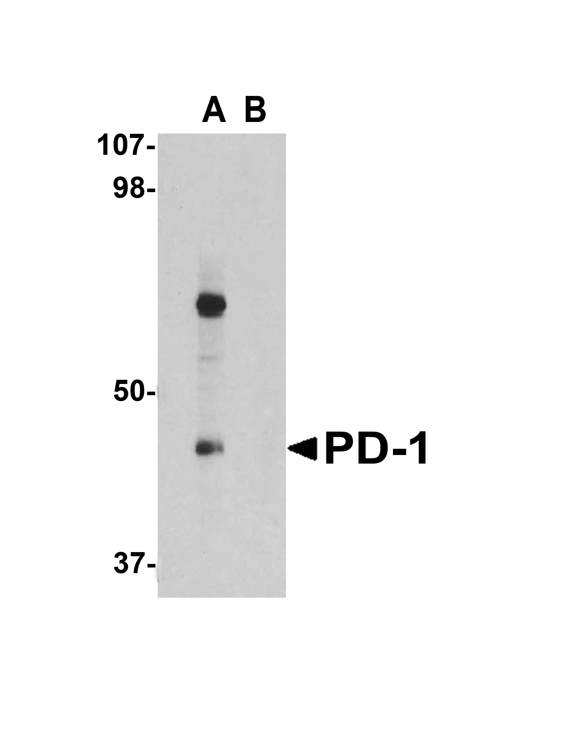 <strong>Figure 5 Western Blot Validation in Rat Thymus Cell Lysate</strong><br>
Loading: 15 μg of lysates per lane.
Antibodies: PD-1 4065 (1 μg/mL), 1h incubation at RT in 5% NFDM/TBST.
Secondary: Goat anti-rabbit IgG HRP conjugate at 1:10000 dilution.