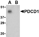 <strong>Figure 4 Western Blot Validation in THP-1 Cell Lysate in the (A) absence and (B) presence of blocking peptide</strong><br>
Loading: 15 μg of lysates per lane.
Antibodies: PD-1, 4065 (1 μg/mL), 1h incubation at RT in 5% NFDM/TBST.
Secondary: Goat anti-rabbit IgG HRP conjugate at 1:10000 dilution.