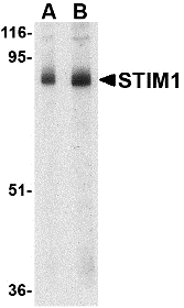 Western blot analysis of STIM1 in mouse thymus tissue lysate with STIM1 antibody at (A) 1 and (B) 2 μg/mL. Western blot analysis of STIM1 in mouse thymus tissue lysate with STIM1 antibody at (A) 1 and (B) 2 μg/mL.